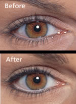 eyes_before_after.jpg