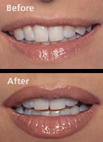 lips_before_after.jpg